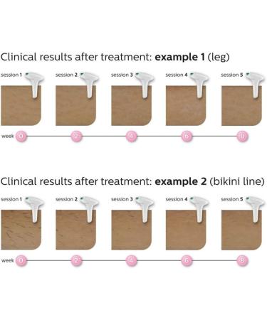 Philips Lumea Advanced IPL Hair Removal System - SC1997/00 for Body & Face - Buy Online on GoSupps.com