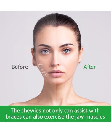 OFFCUP Aligner Chewies 6 pieces seater aligner Chewies tablets alignment pockets seater chewies in 1 colors green 6 Pieces Green - Buy Online on GoSupps.com