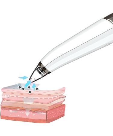 Kapmore Rechargeable USB Pore Electric Cleaner for Women and Girls Acne Tools Acne Electric Remover Portable Acne Electric Remover - Buy Online on GoSupps.com