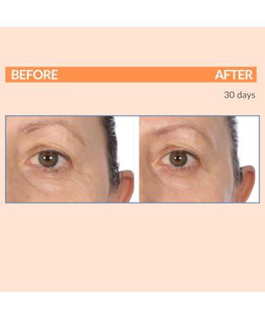 Serious Skincare Serious-C3 Plasma Vitamin C Day Trio | C Cream SPF 30 Vitamin C Serum & C-Eye Treatment for Radiant Skin - Buy Online on GoSupps.com