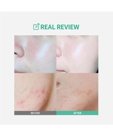 Saeng Cica Barrier Intense Cream | Soothing Korean Skincare Moisturizer for Dry & Irritated Skin - Buy Online on GoSupps.com