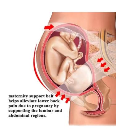 ZiaWorld Care Maternity Pregnancy Support Belt - Pink XXL | Belly Band for Post-Partum Women | Comfortable & Breathable Waist Brace for Bump Support - Buy Online on GoSupps.com