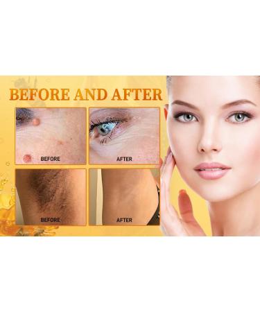 2PCS Bee Venom Cream Bee Venom Skin Treatment Cream for Women for All Skin - Buy Online on GoSupps.com