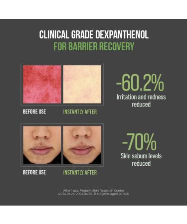 JUMISO D-Panthenol Barrier Soothing Cream (77ml/2.71 oz) 5-Ceramide Complex+Cica+Squalane Lightweight Gel Daily Moisturizer for Sensitive & Acne-Prone Skin Non-Greasy Barrier Support - Buy Online on GoSupps.com