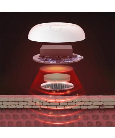 Buy Moxibustion Box Set - Smoke-Free Moxa Acupuncture Heat Massage Device | Eco-Friendly & Intelligent Design - Buy Online on GoSupps.com