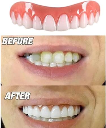 Xzlzmd Silica Gel Dentures - Natural Color Temporary Prosthesis | Instant Repair for Cracked or Missing Teeth | 8 Pairs for Men & Women - Buy Online on GoSupps.com