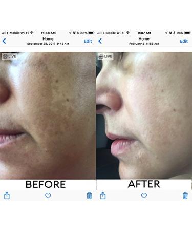 Deluge Vitamin C Face Treatment Oil | Brightening & Repairing with Rosehip Squalane & Jojoba | 30ml - Buy Online on GoSupps.com