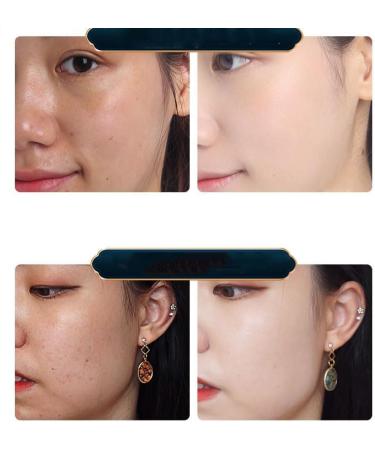  PEYNIR Set of 3 easy-to-apply dragon's blood creams: dragon's blood cream with retinol and placenta easy-to-apply dragon's blood cream anti-aging anti-wrinkle cream moisturizing cream to firm and smooth the skin - Buy Online on GoSupps.com