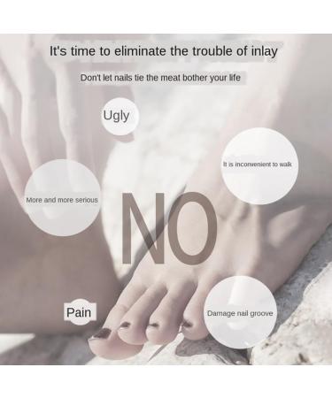 Nail Correction Toe Nail Correction Tool Ingrown Toenail Treatment Tool Painless Inflammation Cure Metal Pedicure Manicure/138 - Buy Online on GoSupps.com