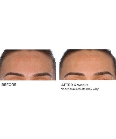 NassifMD Hydro-Gel with Hylauronic Acid Moisturizer Salicylic Acid Serum Retinol Serum for Face - Buy Online on GoSupps.com