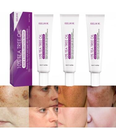 Lot de 3 cr mes pour Las Manchas de La Cara Cremas para Quitar Manchas de La Cara Crema Blanqueadora para Pecas Elimina el Melasma Manchas Oscuras Aclara La Piel