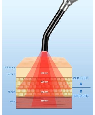 LONLIKE Red Light Therapy Device for Cold Sore & Fever Blister Treatment - Buy Online on GoSupps.com
