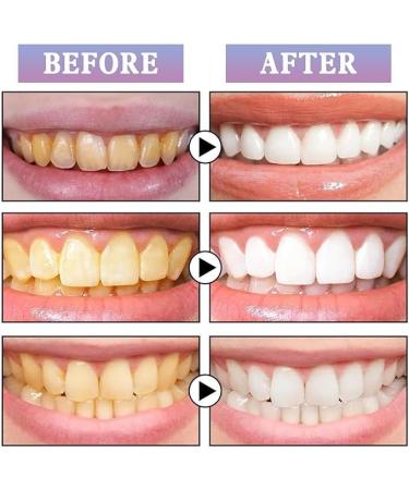 Tooth Gloss - Instant Teeth Whitening Pen & Gel | 2023 Stain Removal | 2PCs - Shine & Brighten Your Smile - Buy Online on GoSupps.com