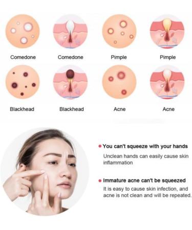 Blackhead Remover Kit Extract Pop and Care for Clear Skin - Acne Comedown Dermatologist Extractor Tool Set for Blemish Facial Skin Care Professional Whitehead Extraction Tweezer Removal - Buy Online on GoSupps.com