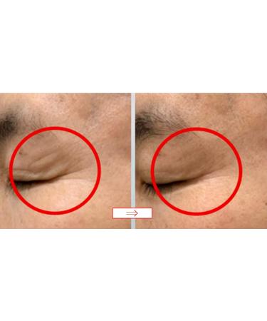 WHITESILK Expert Drop SCM Eye & Neck Lifting Ampoule - 10ml x 2 Vials - Buy Online on GoSupps.com