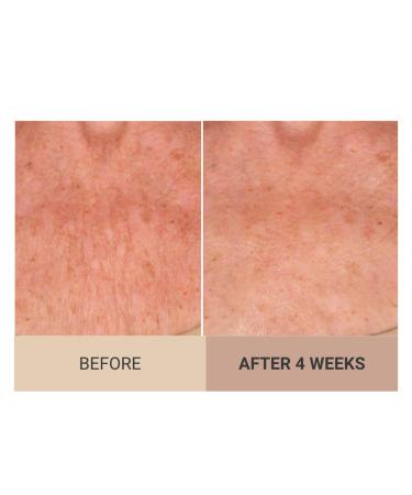 Consult Beaute Unscented Champagne Lift Hydrating Firming Body Cream with Pink Pepperslim Moisturizer Tightens Crepey Skin Tones & Hydrates Dry Skin on Arms & Legs - 8 oz. - Buy Online on GoSupps.com