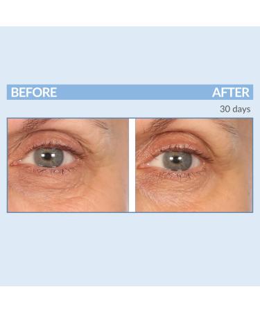 Serious Skincare Eyetality PM - Night Eye Cream with Lash Boosting Peptides for Thicker Longer Lashes - 0.5 oz | International Shipping - Buy Online on GoSupps.com