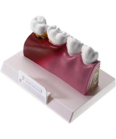 Anatomical Torso & Skeletal Models - 4x4 Teeth Pathologies Removable Teeth for Education & Oral Care | International Shipping - Buy Online on GoSupps.com