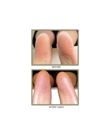 Buy Active Balm Hand & Body Mini - Nourishing Moisturizer for All Skin Types | International Shipping Available - Buy Online on GoSupps.com