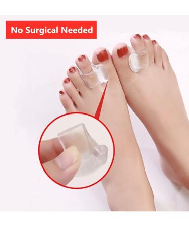 Bunion Splints for Children and Adults - Toe Valgus Corrector & Separator - Buy Online on GoSupps.com