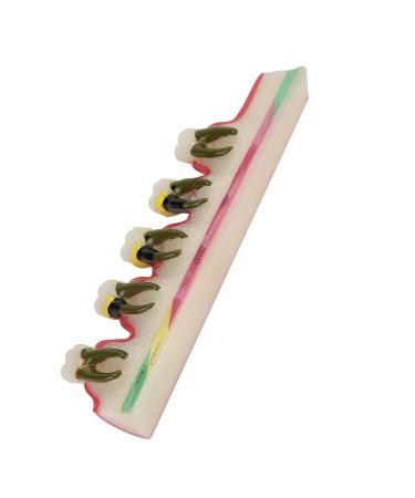 Dental Periodontal Disease Model Tooth Disease Study Teaching Model for Dental School - Buy Online on GoSupps.com