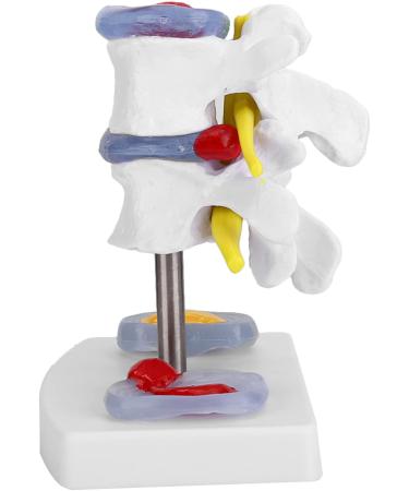 Anatomical Lumbar Intervertebral Disc Model - Spine Demonstration for Training & Education | International Shipping Available - Buy Online on GoSupps.com