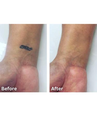 Tattoo Cover Up Makeup  Bruise Concealer  Waterproof  Smudge proof  3 colors + brush  by Dermaflage  6.9g/.24oz Fair - Buy Online on GoSupps.com