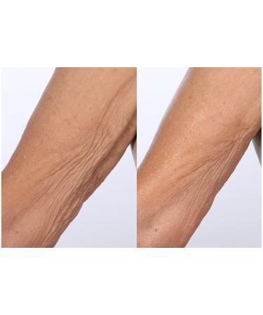 Nakery SkinToning Body Butter | Crepe Smoothing + Repair | Infused with Niacinamide Caffeine Tri-Hyaluronic Acid (Sunshine Bouquet) - Buy Online on GoSupps.com