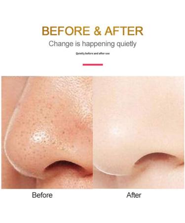 MU Facial Skin Cleaning Agent | Multifunction USB Electrical Detox Cleanser for Deep Face Cleaning & Massage - Buy Online on GoSupps.com