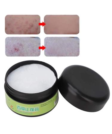 Herbal Itch Relief Cream - 30g | Anti-Itching & Refreshing Skin Care Treatment - Buy Online on GoSupps.com