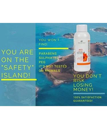 100% Natural Anti Acne Lotion with Ribwort Plantan Silver Birch and Chamomile Tightening and Acne Prevention Lotion 150 ml. - Buy Online on GoSupps.com