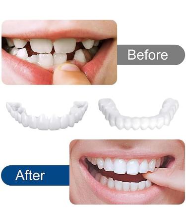 Brigtviee 2 Pairs of Dentures Cosmetic Snap Dentures for Upper and Lower Teeth Temporary Whiter Dentures for Women and Men Comfortable Clipin Veneers - Buy Online on GoSupps.com