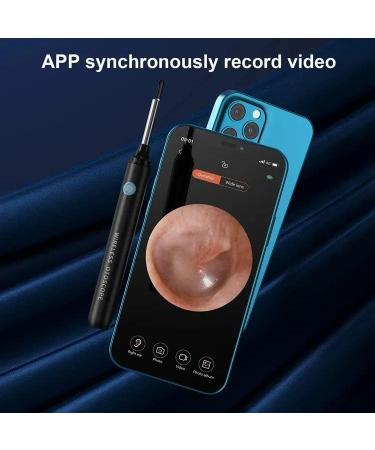Earwax Removal Tool with 5MP Super HD Camera | WiFi Ear Endoscope for iOS & Android | Includes 6 Silicone Earpick Tips and LED Lights - Buy Online on GoSupps.com