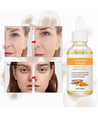 Turmeric face seruem Dark Spot Remover Essence Turmeric Serums for face Brightens Skin Tone Moisturizes Hydrates Lightens Age-Spots Acne Reduce Fine Lines Facial Care Anti-Aging Serum - Buy Online on GoSupps.com