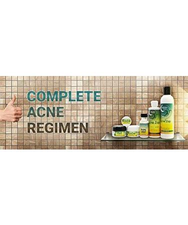 Acne Zap Scalp Shampoo - Clear Scalp from Zits and Pimples 6.0 oz - Buy Online on GoSupps.com