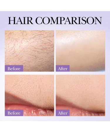 Hair Inhibitor Spray for Face Underarms Legs | Soothing Hair Growth Inhibitor for Men & Women | After Wax Care - Buy Online on GoSupps.com
