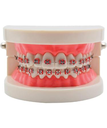 KFO Tooth Model Standard Tooth Teaching Malocclusion KFO Teeth Model with Brackets Archwire Tools - Buy Online on GoSupps.com