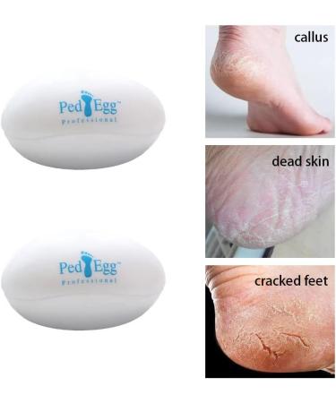 XINGYIYIJIA Egg Shape Foot Scrubber - Foot File for Dead Skin Removal - Buy Online on GoSupps.com
