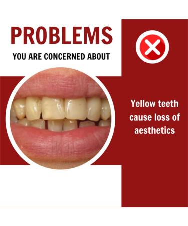 Dazzling White Toothpaste - Instant Whitening & Fresh Breath with Niacinamide | Clean Teeth & Remove Bad Odor (1 PC) - International Shipping Available - Buy Online on GoSupps.com