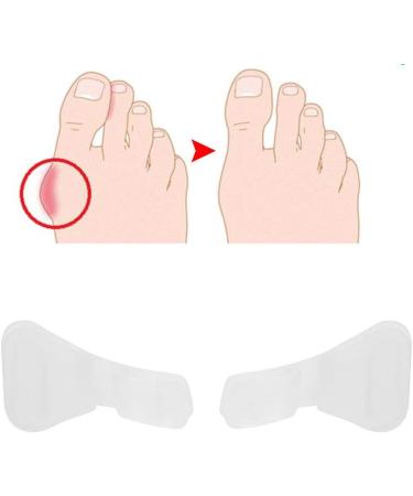 Akozon Hallux Valgus Toe Corrector Set - 5 Pairs | Orthotics Foot Thumb Spreader & Bunion Straightener Tool - Buy Online on GoSupps.com