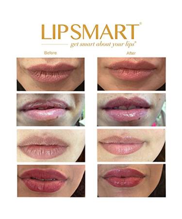 Medical Grade LIPSMART Lip Balm & Hydrating Treatment - 0.33 Fl Oz - Buy Online on GoSupps.com