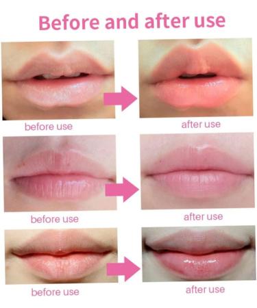 Face Masks Gel Lip Pad Hot Cold Compress Gel Pack Reusable Leakage Proof Swelling Wounds Patches - Buy Online on GoSupps.com