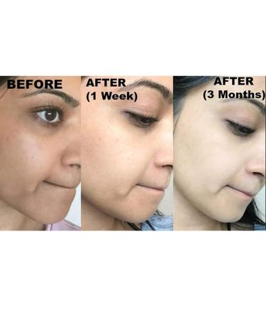 Kojie San Skin Lightening Kojic Acid Soap - 3 Bars for Age Spots Freckles & Acne Scars - 100g | Fade Dark Marks & Sun Damage | Shop Now! - Buy Online on GoSupps.com