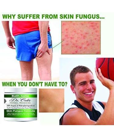 Dr. Cole's Organic Herbal Skin Fungus Soaking Salts - Effective Relief for Skin Fungus Infections - Jock Itch, Athlete's Foot, and More - Buy Online on GoSupps.com