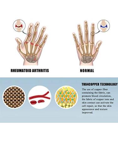 Mokigol Arthritis Gloves for Women - Pain Relief Compression Fingerless Gloves for Daily Work - Large - Buy Online on GoSupps.com