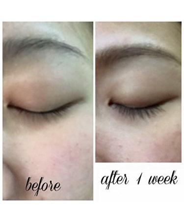LuxeLash Select Lash Serum - Eyelash Rejuvenator for Fuller, Healthier Lashes - Buy Online on GoSupps.com