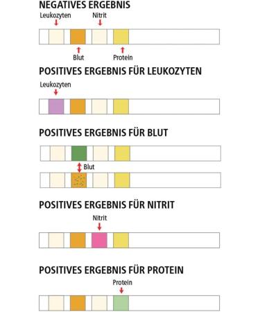 3-Pack Bladder Inflammation Self-Test - Home Urine Test Strips for Quick UTI Detection - Buy Online on GoSupps.com