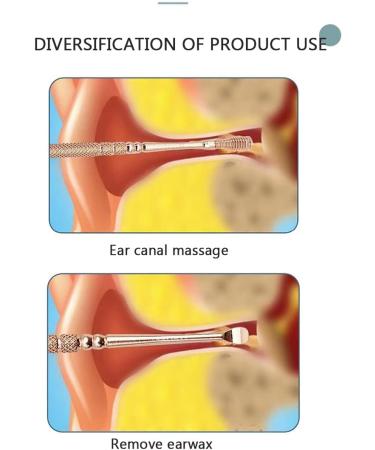 Professional Ear Wax Cleaner Tool Set - Double Ended Stainless Steel Spiral Ear Cleaner with Brush & Storage Box - Effective Ear Wax Removal Kit - Buy Online on GoSupps.com