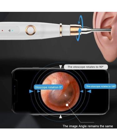 KouRy Portable Ear Cleaner | 200MP HD Camera Ear Wax Removal Tool | Multifunctional Ear Cleaning Solution - Buy Online on GoSupps.com