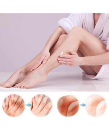 Acanthosis Nigricans Cream Whitening Cream Underarm Whitening Cream Brightening Cream Effectively Lightens Melanin Neck Ankle Knee - Buy Online on GoSupps.com